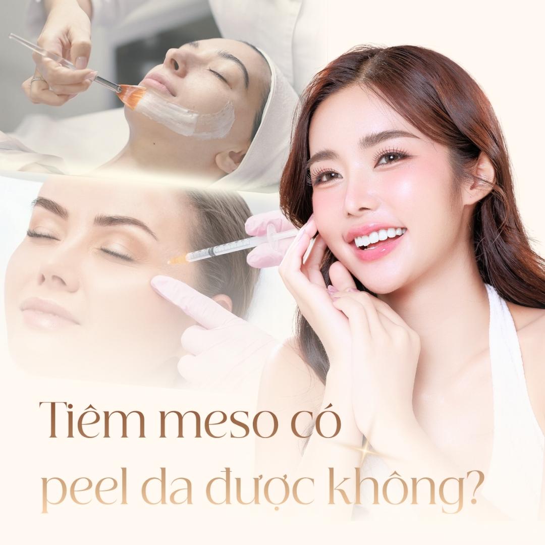 Tiêm meso có peel da được không?